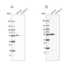 Western blot analysis using Anti-FKBP5 antibody HPA031092 (A) shows similar pattern to independent antibody HPA031093 (B).