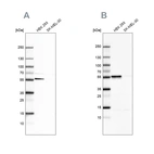 Western blot analysis using Anti-FKBP5 antibody HPA031092 (A) shows similar pattern to independent antibody HPA031093 (B).