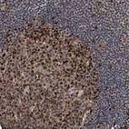 Anti-FKBP5 Antibody