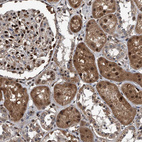 Immunohistochemical staining of human kidney shows moderate to strong nuclear positivity in cells in tubules.