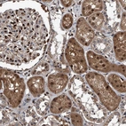 Immunohistochemical staining of human kidney shows moderate to strong nuclear positivity in cells in tubules.
