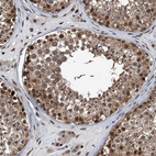 Immunohistochemical staining of human testis shows moderate to strong nuclear positivity in cells in seminiferous ducts.