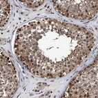 Immunohistochemical staining of human testis shows moderate to strong nuclear positivity in cells in seminiferous ducts.