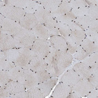 Immunohistochemical staining of human skeletal muscle shows strong nuclear positivity in myocytes.