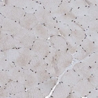 Immunohistochemical staining of human skeletal muscle shows strong nuclear positivity in myocytes.