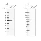 Western blot analysis using Anti-FKBP5 antibody HPA031093 (A) shows similar pattern to independent antibody HPA031092 (B).