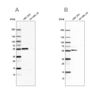 Western blot analysis using Anti-FKBP5 antibody HPA031093 (A) shows similar pattern to independent antibody HPA031092 (B).