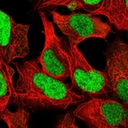 Immunofluorescent staining of human cell line HEK 293 shows localization to nucleoplasm.
