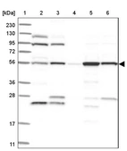 Lane 1: Marker [kDa] 230, 130, 95, 72, 56, 36, 28, 17, 11_br/_Lane 2: Human cell line RT-4_br/_Lane 3: Human cell line U-251MG sp_br/_Lane 4: Human plasma (IgG/HSA depleted)_br/_Lane 5: Human liver tissue_br/_Lane 6: Human tonsil tissue