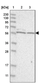Lane 1: Marker [kDa] 230, 130, 95, 72, 56, 36, 28, 17, 11_br/_Lane 2: Human cell line RT-4_br/_Lane 3: Human cell line U-251MG sp