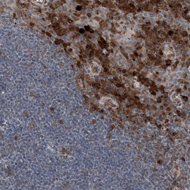 Anti-THEMIS2 Antibody