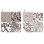 Anti-ZC3H15 Antibody