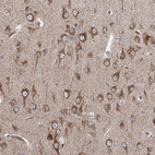 Immunohistochemical staining of human cerebral cortex shows strong cytoplasmic positivity in neurons.