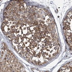 Immunohistochemical staining of human testis shows strong cytoplasmic positivity in cells in seminiferous ducts.