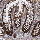 Immunohistochemical staining of human colon shows strong cytoplasmic positivity in glandular cells.