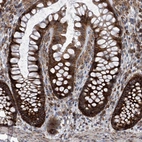 Immunohistochemical staining of human colon shows strong cytoplasmic positivity in glandular cells.