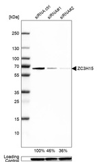 Western blot analysis in Caco-2 cells transfected with control siRNA, target specific siRNA probe #1 and #2, using Anti-ZC3H15 antibody. Remaining relative intensity is presented. Loading control: Anti-GAPDH.