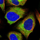 Immunofluorescent staining of human cell line U-2 OS shows localization to cytosol.