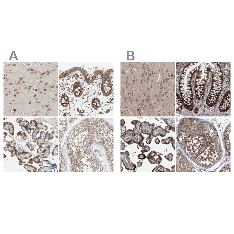 Anti-ZC3H15 Antibody