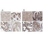 Anti-ZC3H15 Antibody