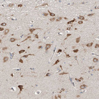 Immunohistochemical staining of human cerebral cortex shows strong cytoplasmic positivity in neurons.