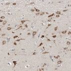 Immunohistochemical staining of human cerebral cortex shows strong cytoplasmic positivity in neurons.