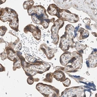 Immunohistochemical staining of human placenta shows strong cytoplasmic positivity in trophoblastic cells.