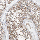 Immunohistochemical staining of human testis shows strong cytoplasmic positivity in cells in seminiferous ducts.