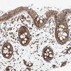 Immunohistochemical staining of human colon shows strong cytoplasmic positivity in glandular cells.