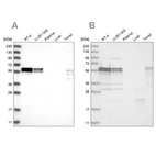 Western blot analysis using Anti-ZC3H15 antibody HPA031100 (A) shows similar pattern to independent antibody HPA031101 (B).
