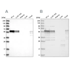 Western blot analysis using Anti-ZC3H15 antibody HPA031100 (A) shows similar pattern to independent antibody HPA031101 (B).