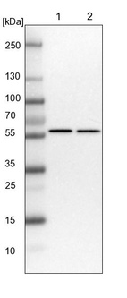 Lane 1: NIH-3T3 cell lysate (Mouse embryonic fibroblast cells)_br/_Lane 2: NBT-II cell lysate (Rat Wistar bladder tumour cells)