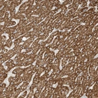 Immunohistochemical staining of human liver shows strong granular cytoplasmic positivity in hepatocytes.