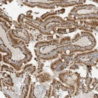 Immunohistochemical staining of human duodenum shows strong granular cytoplasmic positivity in glandular cells.