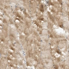 Immunohistochemical staining of human skeletal muscle shows moderate cytoplasmic positivity in myocytes.