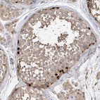 Anti-OFD1 Antibody