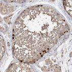 Anti-OFD1 Antibody