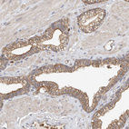 Immunohistochemical staining of human prostate shows moderate membranous positivity in glandular cells.