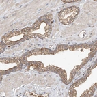Immunohistochemical staining of human prostate shows moderate membranous positivity in glandular cells.