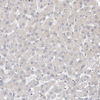 Immunohistochemical staining of human liver shows no positivity in hepatocytes as expected.