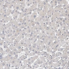 Immunohistochemical staining of human liver shows no positivity in hepatocytes as expected.