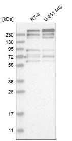 Western blot analysis in human cell line RT-4 and human cell line U-251 MG.