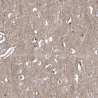 Immunohistochemical staining of human cerebral cortex shows moderate cytoplasmic positivity in neuropil.