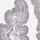 Immunohistochemical staining of human fallopian tube shows moderate positivity in cilia in glandular cells.