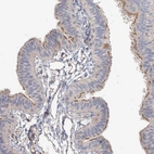 Immunohistochemical staining of human fallopian tube shows moderate positivity in cilia in glandular cells.