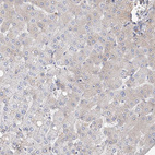Immunohistochemical staining of human liver shows no positivity in hepatocytes as expected.