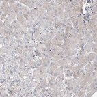 Immunohistochemical staining of human liver shows no positivity in hepatocytes as expected.