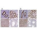 Immunohistochemical staining of human endometrium, kidney, liver and testis using Anti-KMO antibody HPA031115 (A) shows similar protein distribution across tissues to independent antibody HPA056942 (B).