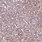 Immunohistochemical staining of human liver shows strong cytoplasmic granular positivity in hepatocytes.