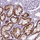 Immunohistochemical staining of human kidney shows strong cytoplasmic granular positivity in cells in tubules.